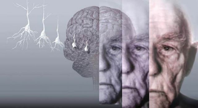 Hareketsizlik alzheimer ihtimalini 3 kat artırıyor