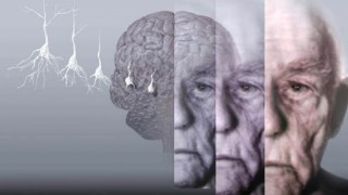 Hareketsizlik alzheimer ihtimalini 3 kat artırıyor